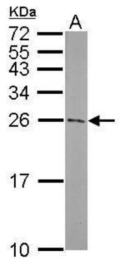 Invitrogen ATG5 Polyclonal Antibody 100 &mu;L; Unconjugated:Antibodies,