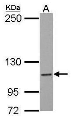 Invitrogen NLRC4 Polyclonal Antibody 100 &mu;L; Unconjugated:Antibodies,