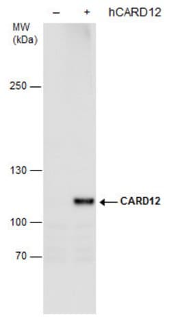 Invitrogen NLRC4 Polyclonal Antibody 100 &mu;L; Unconjugated:Antibodies,