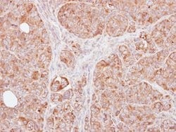 Invitrogen TRAF1 Polyclonal Antibody 100 &mu;L; Unconjugated:Antibodies,