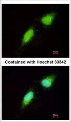 Invitrogen NADE Polyclonal Antibody 100 &mu;L; Unconjugated:Antibodies,