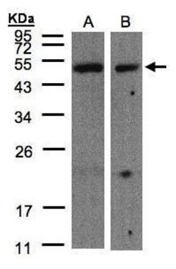 CARD8 Polyclonal Antibody, Invitrogen 100 μL; Unconjugated:Antibodies,