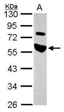 Invitrogen TRIP Polyclonal Antibody 100 &mu;L; Unconjugated:Antibodies,