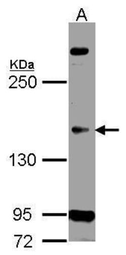 Invitrogen CDK13 Polyclonal Antibody 100 &mu;L; Unconjugated:Antibodies,