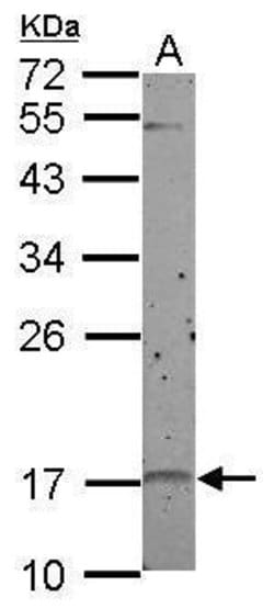Invitrogen p19 INK4d Polyclonal Antibody 100 &mu;L; Unconjugated:Antibodies,