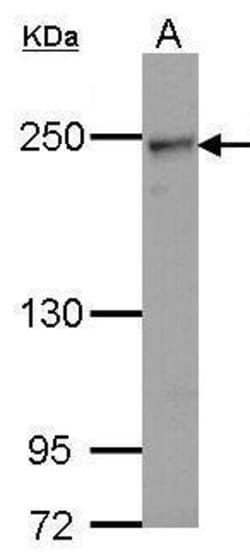 Invitrogen COL4A2 Polyclonal Antibody 100 &mu;L; Unconjugated:Anticuerpos