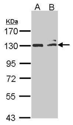 Invitrogen NIK Polyclonal Antibody 100 &mu;L; Unconjugated:Antibodies,