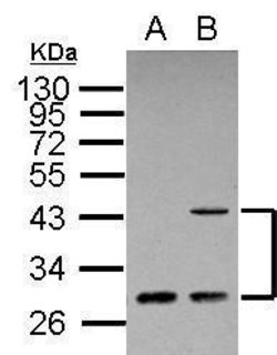 Invitrogen ING1 Polyclonal Antibody 100 &mu;L | Buy Online | Invitrogen&trade; | Fisher Scientific