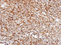 Invitrogen GRK3 Polyclonal Antibody 100 &mu;L; Unconjugated:Antibodies,