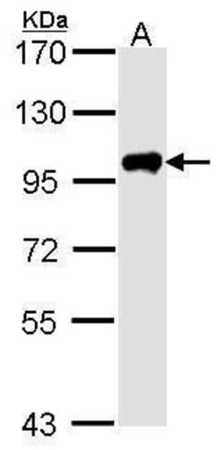 Invitrogen Calpain 3 Polyclonal Antibody 100 &mu;L; Unconjugated:Anticuerpos