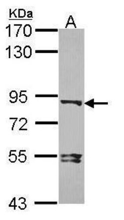 Invitrogen DVL3 Polyclonal Antibody 100 &mu;L | Buy Online | Invitrogen&trade; | Fisher Scientific