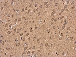 GABBR1 Polyclonal Antibody, Invitrogen 100 &mu;L; Unconjugated:Antibodies,