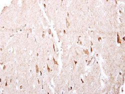 GABBR1 Polyclonal Antibody, Invitrogen 100 &mu;L; Unconjugated:Antibodies,