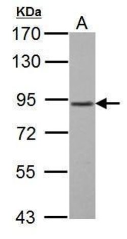 GABBR1 Polyclonal Antibody, Invitrogen 100 &mu;L; Unconjugated:Antibodies,