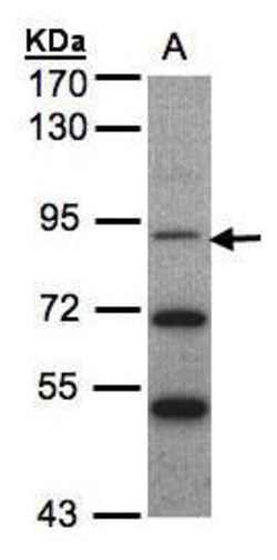 TrkC Polyclonal Antibody, Invitrogen 100 &mu;L; Unconjugated:Antibodies,