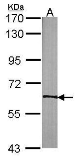 TrkC Polyclonal Antibody, Invitrogen 100 &mu;L; Unconjugated:Antibodies,