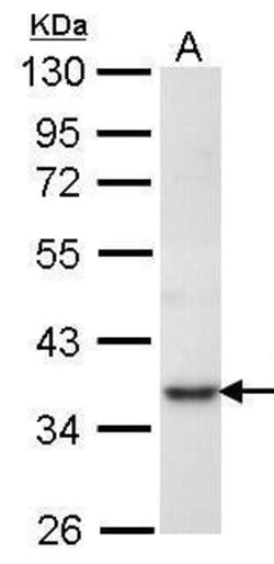 Invitrogen PRPS1 Polyclonal Antibody 100 &mu;L; Unconjugated:Antibodies,