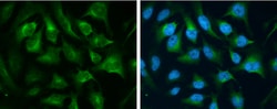 Invitrogen Transferrin Receptor Polyclonal Antibody 100 &mu;L; Unconjugated:Antibodies,