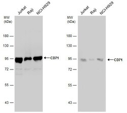 Invitrogen Transferrin Receptor Polyclonal Antibody 100 &mu;L; Unconjugated:Antibodies,