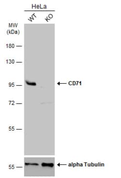 Invitrogen Transferrin Receptor Polyclonal Antibody 100 &mu;L; Unconjugated:Antibodies,