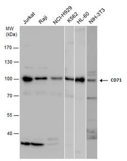 Invitrogen Transferrin Receptor Polyclonal Antibody 100 &mu;L; Unconjugated:Antibodies,