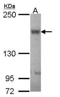 Invitrogen ABCB11 Polyclonal Antibody 100 μL; Unconjugated:Antibodies,
