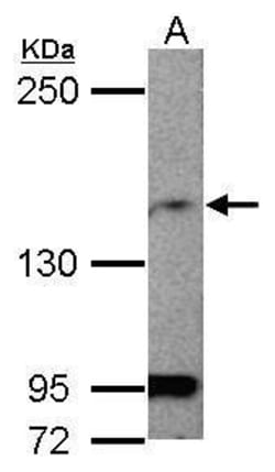 Invitrogen MAGI1 Polyclonal Antibody 100 &mu;L; Unconjugated:Antibodies,