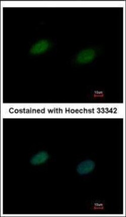 Invitrogen UBA2 Polyclonal Antibody 100 &mu;L; Unconjugated:Antibodies,
