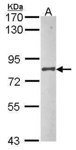Invitrogen UBA2 Polyclonal Antibody 100 &mu;L; Unconjugated:Antibodies,