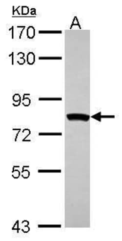 Invitrogen MTMR2 Polyclonal Antibody 100 &mu;L; Unconjugated:Antibodies,