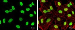 Invitrogen TOP2B Polyclonal Antibody 100 μL; Unconjugated:Antibodies,