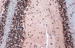 Invitrogen TOP2B Polyclonal Antibody 100 μL; Unconjugated:Antibodies,