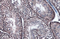 Invitrogen TOP2B Polyclonal Antibody 100 μL; Unconjugated:Antibodies,