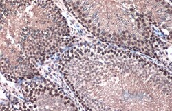 Invitrogen TOP2B Polyclonal Antibody 100 μL; Unconjugated:Antibodies,