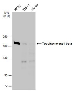 Invitrogen TOP2B Polyclonal Antibody 100 μL; Unconjugated:Antibodies,