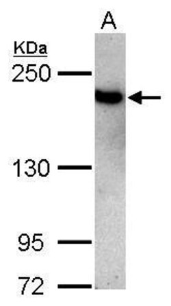 Invitrogen TOP2B Polyclonal Antibody 100 μL; Unconjugated:Antibodies,