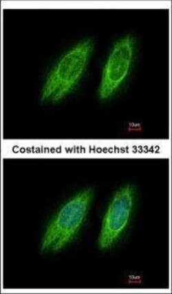 Invitrogen GBF1 Polyclonal Antibody 100 &mu;L; Unconjugated:Antibodies,