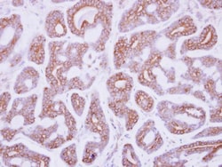 Invitrogen DDR2 Polyclonal Antibody 100 &mu;L; Unconjugated:Antibodies,