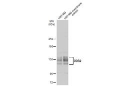 Invitrogen DDR2 Polyclonal Antibody 100 &mu;L; Unconjugated:Antibodies,