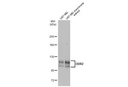 Invitrogen DDR2 Polyclonal Antibody 100 &mu;L; Unconjugated:Antibodies,