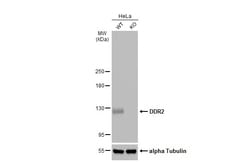 Invitrogen DDR2 Polyclonal Antibody 100 &mu;L | Buy Online | Invitrogen&trade; | Fisher Scientific