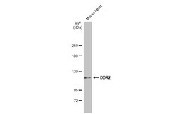 Invitrogen DDR2 Polyclonal Antibody 100 &mu;L; Unconjugated:Antibodies,