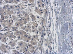 Invitrogen PPME1 Polyclonal Antibody 100 &mu;L; Unconjugated:Anticuerpos