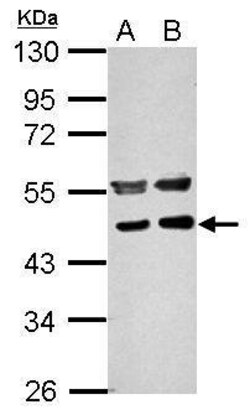 Invitrogen PPME1 Polyclonal Antibody 100 &mu;L; Unconjugated:Anticuerpos