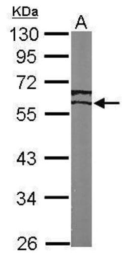 Invitrogen ESRRG Polyclonal Antibody 100 &mu;L; Unconjugated:Antibodies,