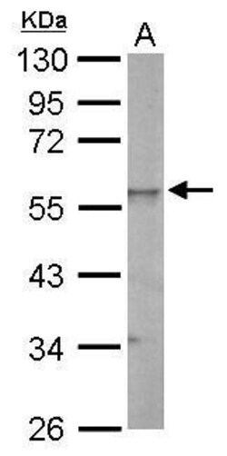 Invitrogen ESRRG Polyclonal Antibody 100 &mu;L; Unconjugated:Antibodies,