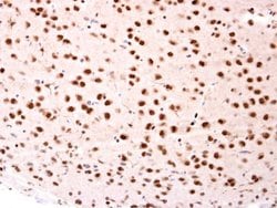 Invitrogen BTRC Polyclonal Antibody 100 &mu;L; Unconjugated:Antibodies,