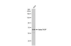 Invitrogen BTRC Polyclonal Antibody 100 &mu;L; Unconjugated:Antibodies,