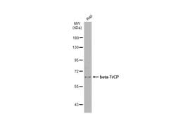 Invitrogen BTRC Polyclonal Antibody 100 &mu;L; Unconjugated:Antibodies,