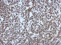 Invitrogen MDC1 Polyclonal Antibody 100 &mu;L | Buy Online | Invitrogen&trade; | Fisher Scientific